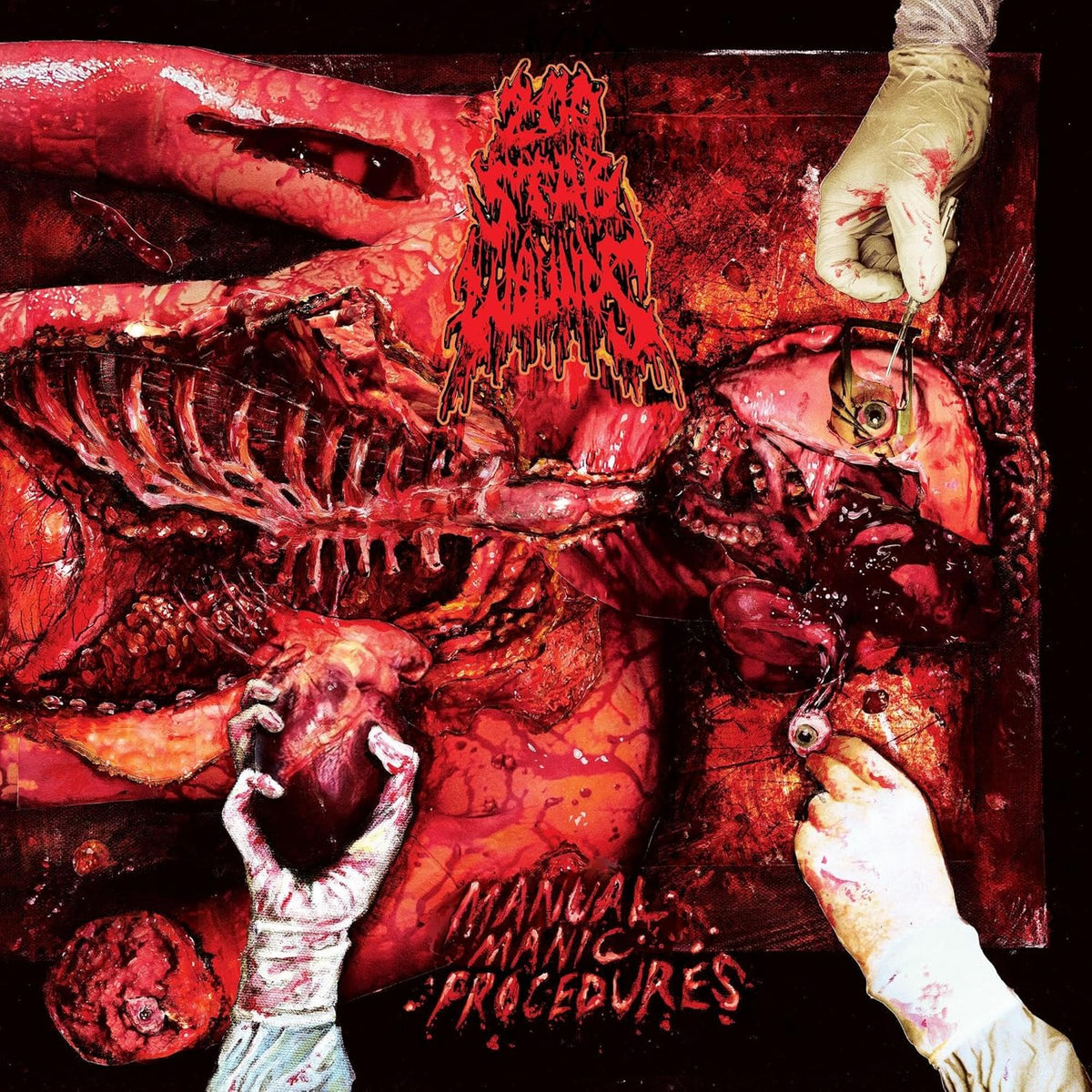 LP - 200 Stab Wounds - Manual Manic Procedures